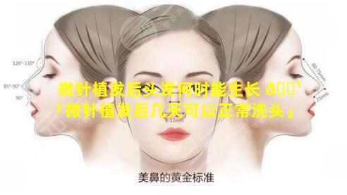 微针植发后头发何时能生长 🌹 「微针植发后几天可以正常洗头」